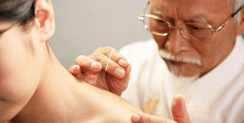 Иглоукалывание