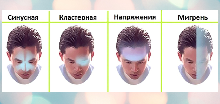 типы головной боли,