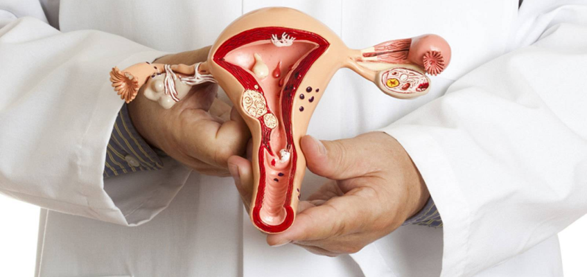 признаки миомы матки у женщин