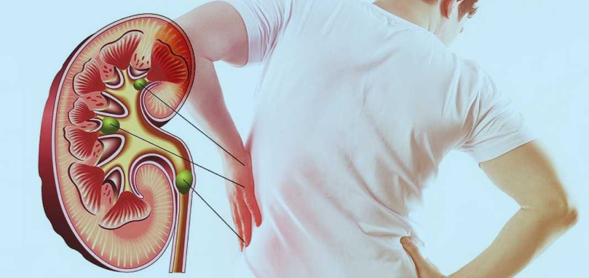 заболевание почек
