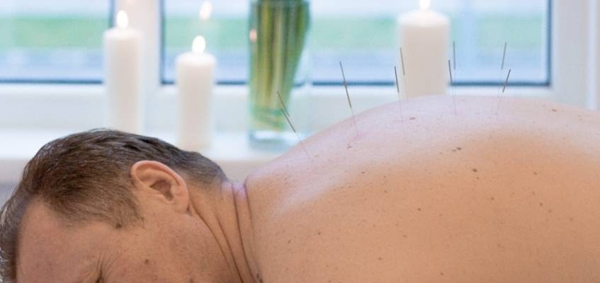 Мужчина с иглами в спине лежит