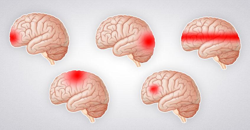 Головной мозг