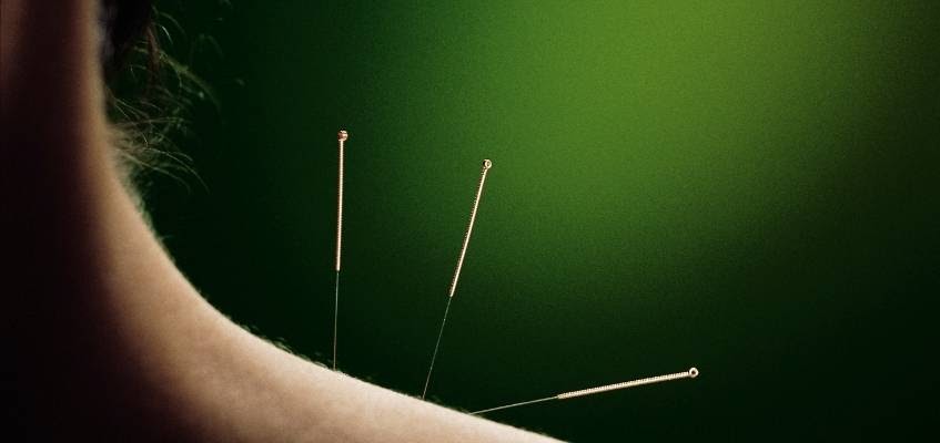 Иглы в плече